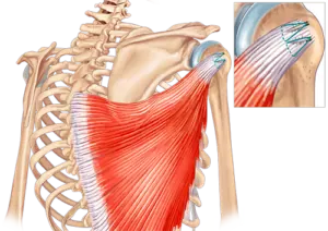 Transfert Tendineux du Grand Dorsal